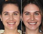 Before and After Photos |