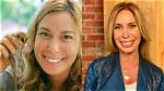 Dr. Mireya Mayor Lips Surgery: Transforming Smiles with Expertise
