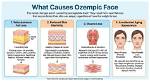 Exploring the Phenomenon of Ozempic Face: Causes, Effects, and Solutions