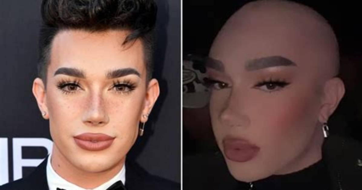 James Charles Bald: the Transformation of a Beauty Icon
