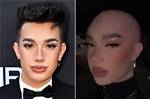 James Charles Bald: the Transformation of a Beauty Icon