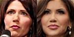 Kristi Noem Plastic Surgery: a Comprehensive Look