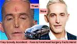 What Happened to Trey Gowdy's Nose? Unraveling the Mystery